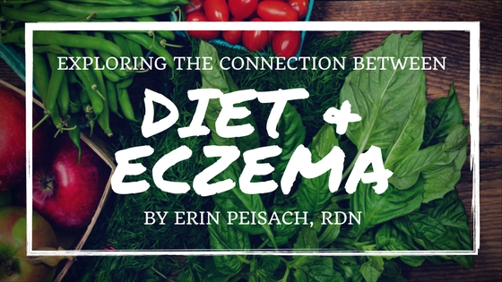 Diet and Eczema 